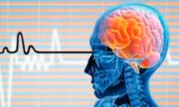 علائم سکته مغزی در مردان